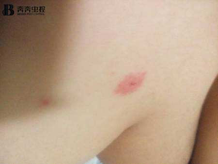 對抗蚊子塊的“終極武器”究竟是什么？